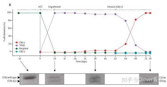 艾滋病治愈_治愈艾滋病有希望吗_治愈的艾滋病