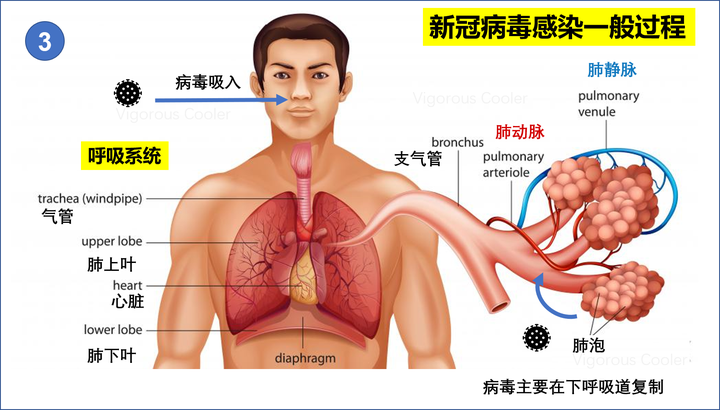 急性艾滋病感染期的临床表现_艾滋病急性期_急性艾滋病感染期的主要表现