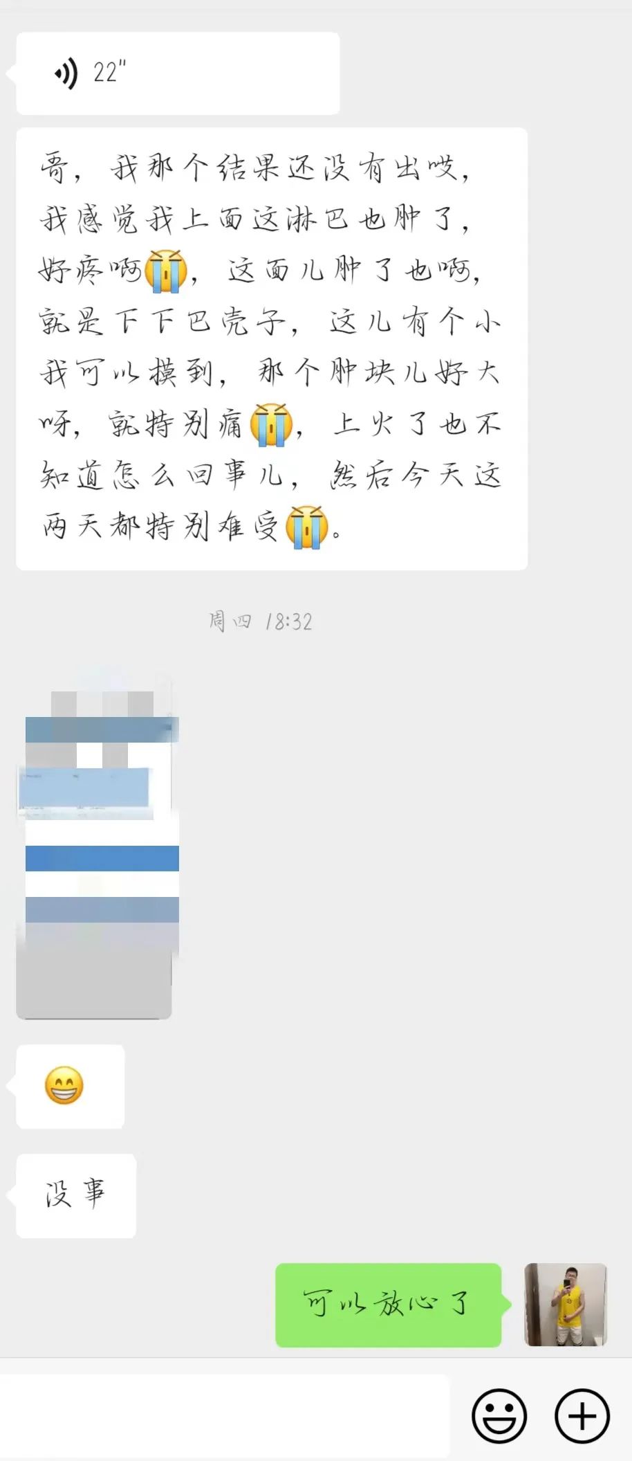 艾滋病急性期_艾滋病急性期具有传染性吗_急性期艾滋病症状