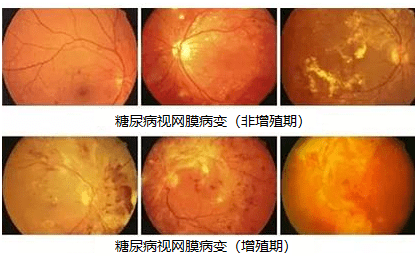 恐艾强迫症_恐艾脱恐_恐艾