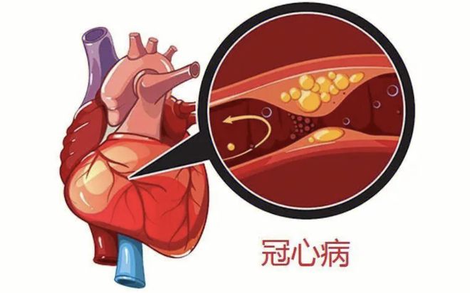 治愈的艾滋病患者_治愈艾滋病的又一人_艾滋病治愈