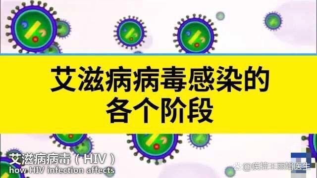 艾滋病急性期_急性艾滋病感染期的主要表现_急性期艾滋病患者自述症状