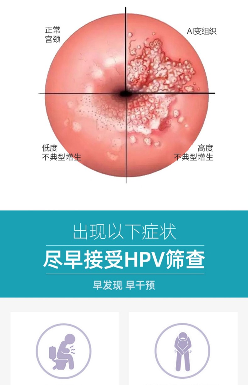 艾滋病患者自诉如何得病_艾滋病自述感染症状_艾滋病自述