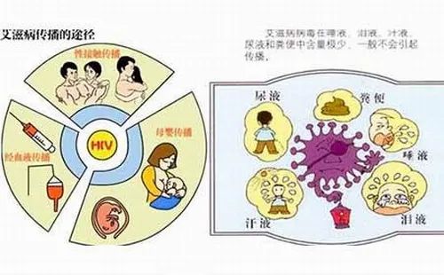 艾滋病初期_初期艾滋病能活多久_初期艾滋病患者症状