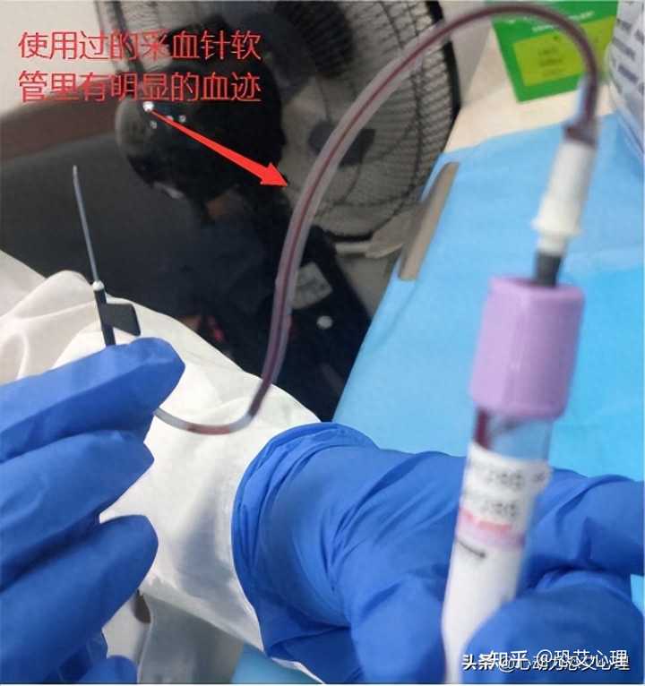 恐艾强迫症_恐艾_低级恐艾如何脱恐