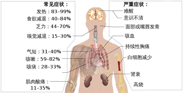 感染艾滋病自诉_艾滋病者自述_艾滋病自述