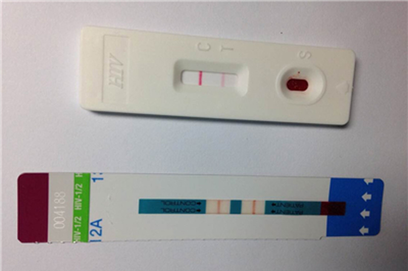 艾滋病试纸检测结果为阳性