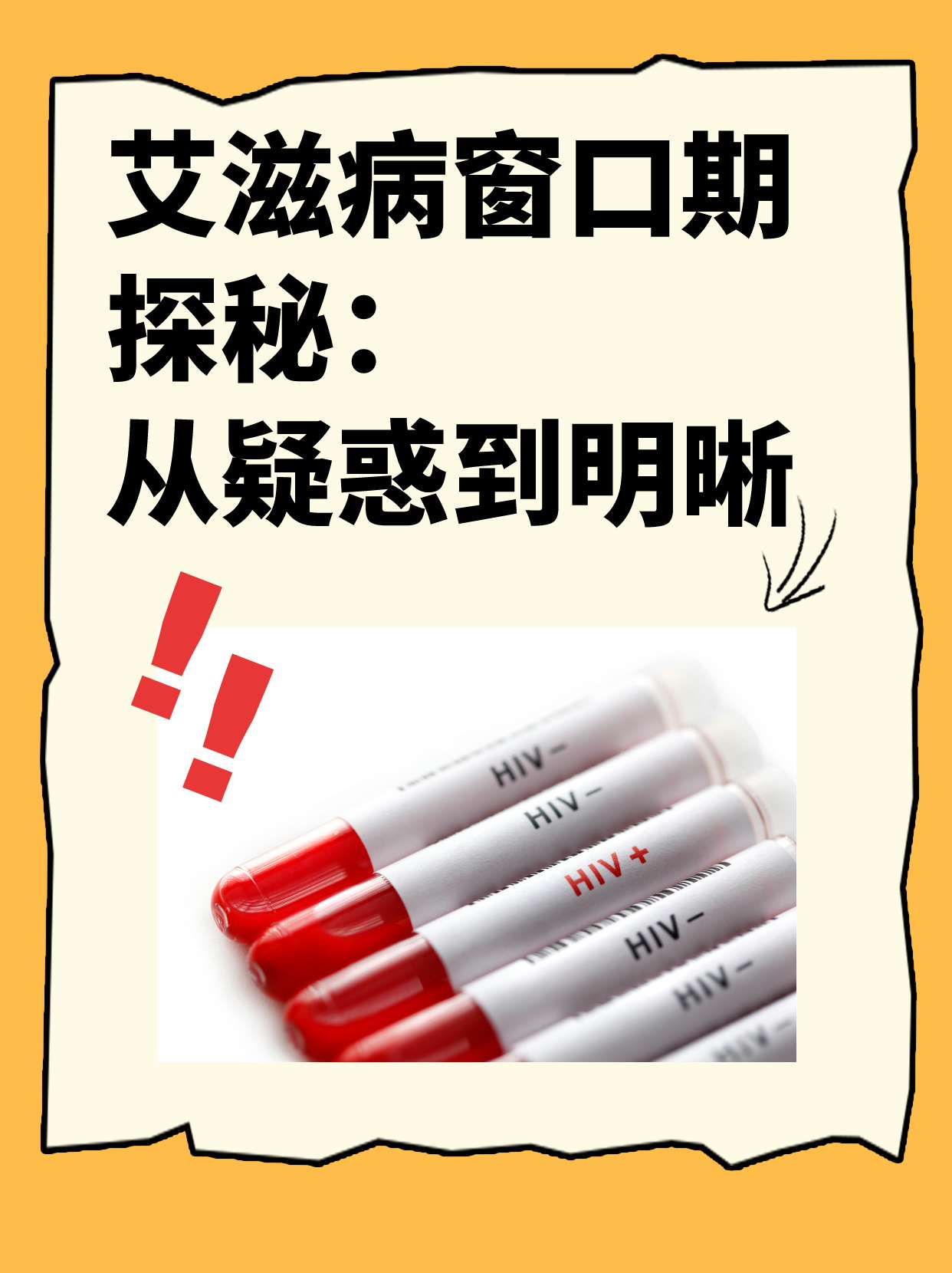 急性期艾滋病患者自述症状_艾滋病急性期_急性艾滋病感染期的主要表现