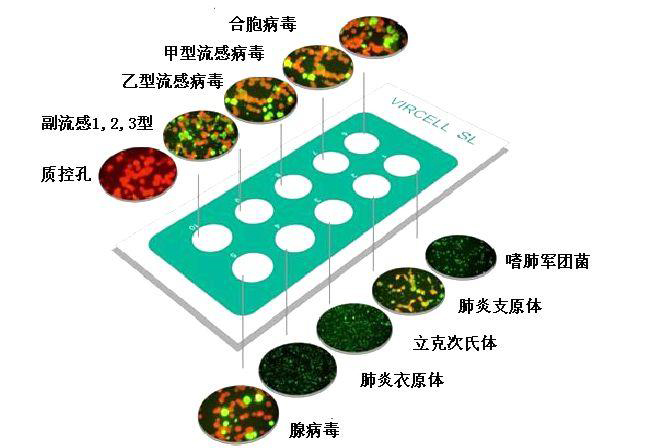 急性期艾滋病患者自述症状_艾滋病急性期具有传染性吗_艾滋病急性期