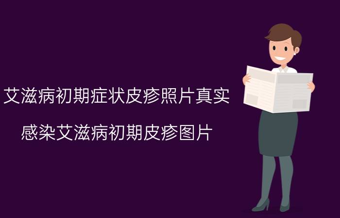 初期艾滋病患者症状_初期艾滋病能活多久_艾滋病初期