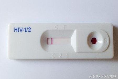 初期艾滋病患者症状_初期艾滋病的症状_艾滋病初期