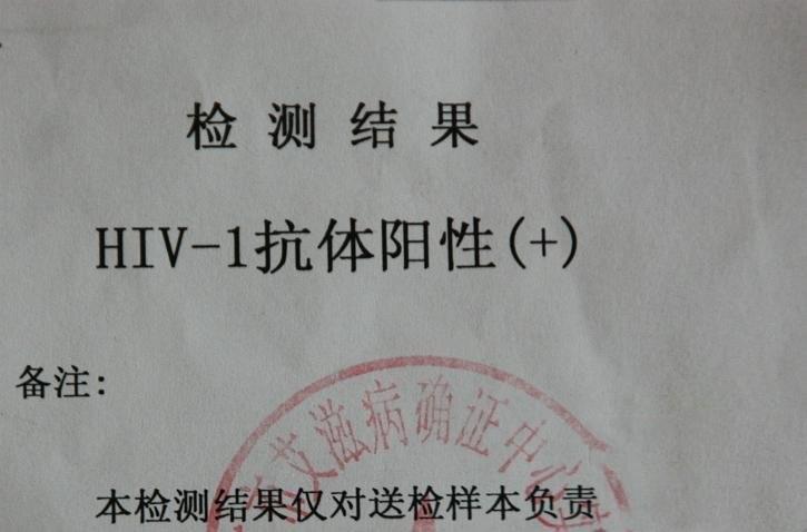 艾滋病急性期_急性期艾滋病患者自述症状_急性艾滋病感染期的临床表现