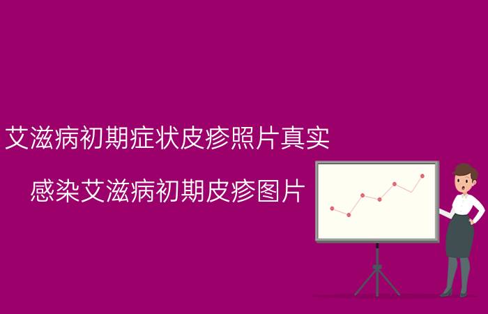 艾滋病自述_艾滋病的自述文章1000字_艾滋病患者自诉如何得病