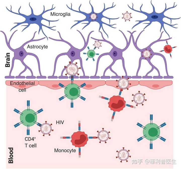 治愈艾滋病_治愈艾滋病的又一人_治愈的艾滋病