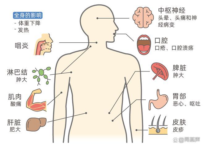 治愈艾滋病_治愈的艾滋病患者_治愈艾滋病有希望吗