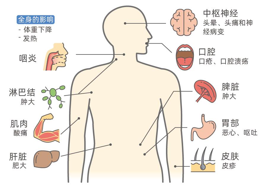 治愈的艾滋病_治愈的艾滋病人_治愈艾滋病